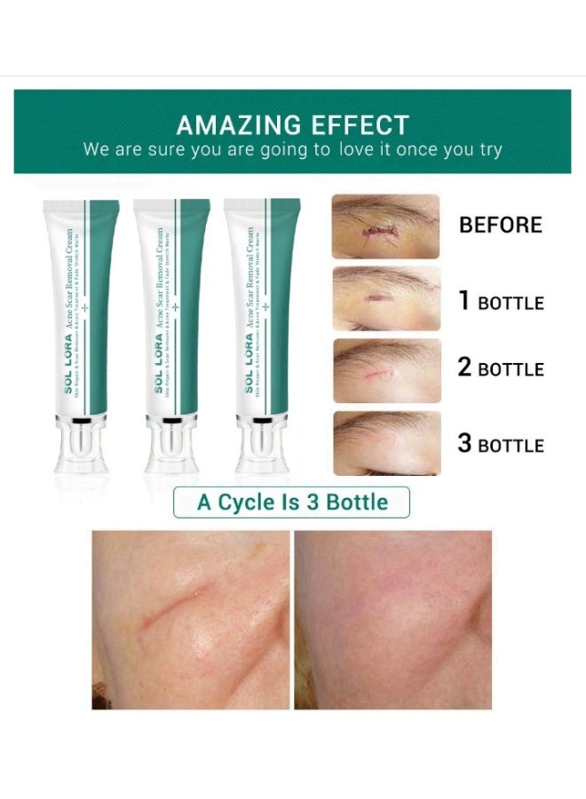 SOL LORA Multi-Effect Scar Removal Cream, Acne Treatment, Scar Fading, and Blemish Smoothing 30g - Image 2